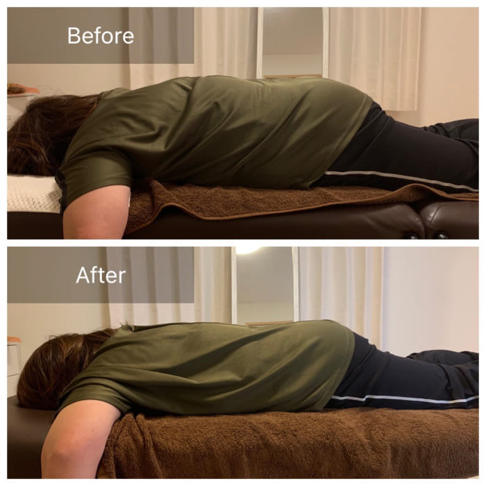 腰痛のビフォーアフターの画像